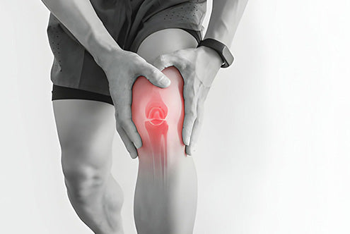 Best Knee Sleeves for Arthritis