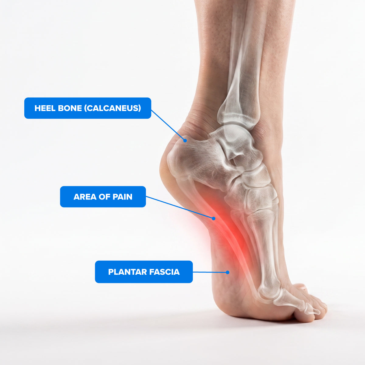 Koprez® Foot Sleeve